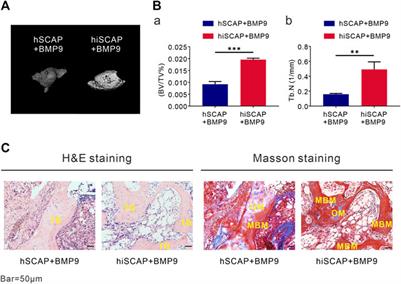 Establishing and characterizing human stem cells from the apical papilla immortalized by hTERT gene transfer